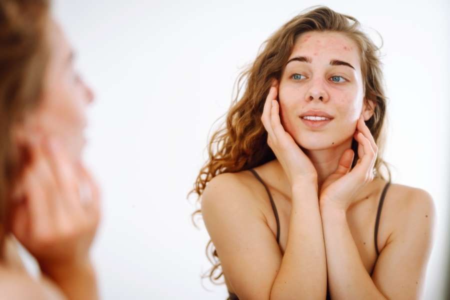Une jeune femme se regarde dans le miroir en observant des rougeurs et de l'acné sur son visage.